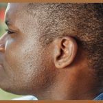 윤곽성형, 나만을 위한 아름다움 디자인