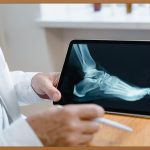 대전 무릎 병원, 튼튼한 관절 건강 되찾는 법