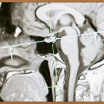 치매 걱정 끝! 무료 치매 테스트로 알아보세요