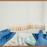 치열, 참지 말고 똑똑하게 관리하자!