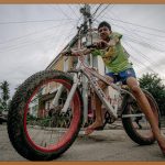 눈꺼풀지방 제거, 시원한 눈매 완성!