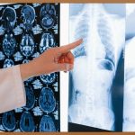 혈뇨, 걱정 멈추고 건강 되찾는 법