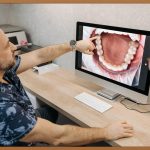 인플란트, 현명한 선택을 위한 모든 것