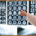 인천 치아 교정, 후회 없는 선택을 위한 완벽 가이드