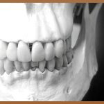 구강암 수술, 궁금증을 속 시원하게 풀어드립니다