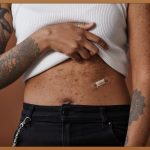 여드름과의 작별: 완벽 케어 가이드