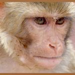 서면 턱보톡스, 합리적인 선택일까?