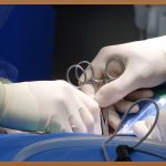 서산 성형외과, 합리적인 선택 가이드