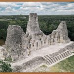 관자놀이 필러, 밋밋한 인상, 이제 안녕!