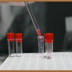 수의대 편입, 꿈을 향한 새로운 기회