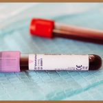 손등 핏줄, 숨겨진 건강 신호?