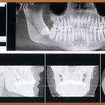 안양 교정 치과, 후회 없는 선택을 위한 완벽 가이드
