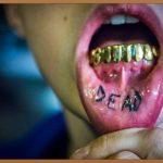 이갈이, 잠자는 당신의 건강을 위협하는 소리 없는 공포