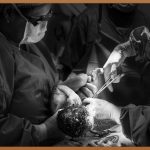 경추수술, 당신의 목 건강을 되찾는 여정