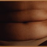 청담오라클 피부과, 0원 혜택 받고 피부 미인 되세요!