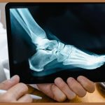 천호동 피부과, 당신의 피부 고민 해결사