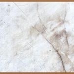 쇄골 골절, 예상치 못한 순간의 위험, 극복 가이드