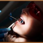 덧니 교정, 숨겨진 진실과 현명한 선택