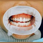 🦷 튼튼한 치아, 건강한 미소! 치아 건강 영양제 완벽 가이드