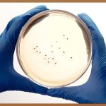 효소유산균, 장 건강 지킴이? 제대로 알고 먹자!