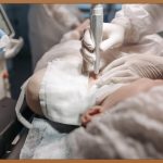 얼굴흉터, 깨끗한 피부 되찾는 여정