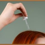 머리에 여드름? 원인부터 관리법까지 꼼꼼하게 파헤치기