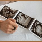 임신, 간절한 당신을 위한 특별 가이드