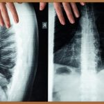 정형외과 전문의, 당신의 뼈 건강을 책임지는 최고의 파트너