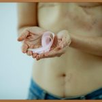 흉터 색소침착, 콤플렉스 탈출! 완벽 가이드