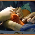 선릉역 근처 정형외과, 당신의 건강 파트너를 찾아서