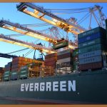 단일공복강경: 흉터 걱정 없는 수술의 새로운 기준