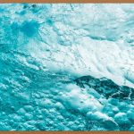 송파 아쿠아필, 피부 고민 끝! 꿀팁 대방출